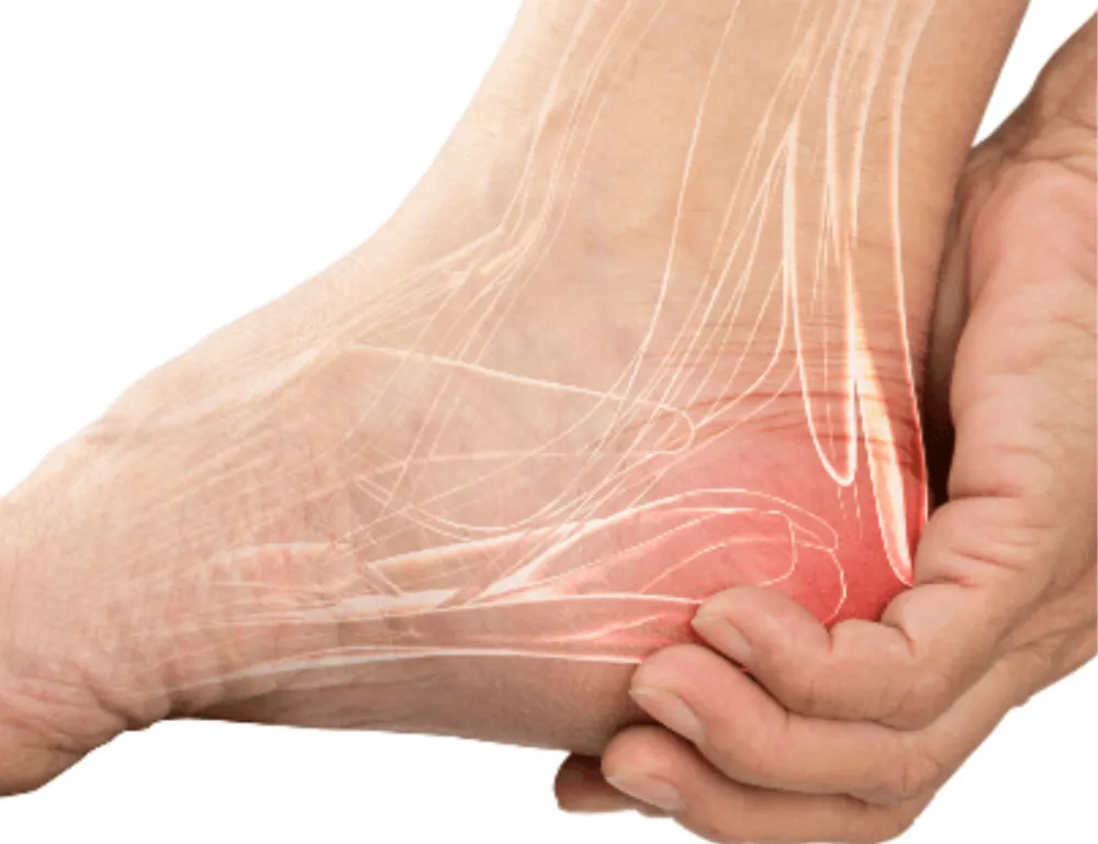 Close-up of a person holding their heel in pain, highlighting the area with inflammation, common in conditions like severe arthritis or plantar fasciitis